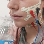 Vitalstim, un dispositivo para mejorar la degluci&oacute;n