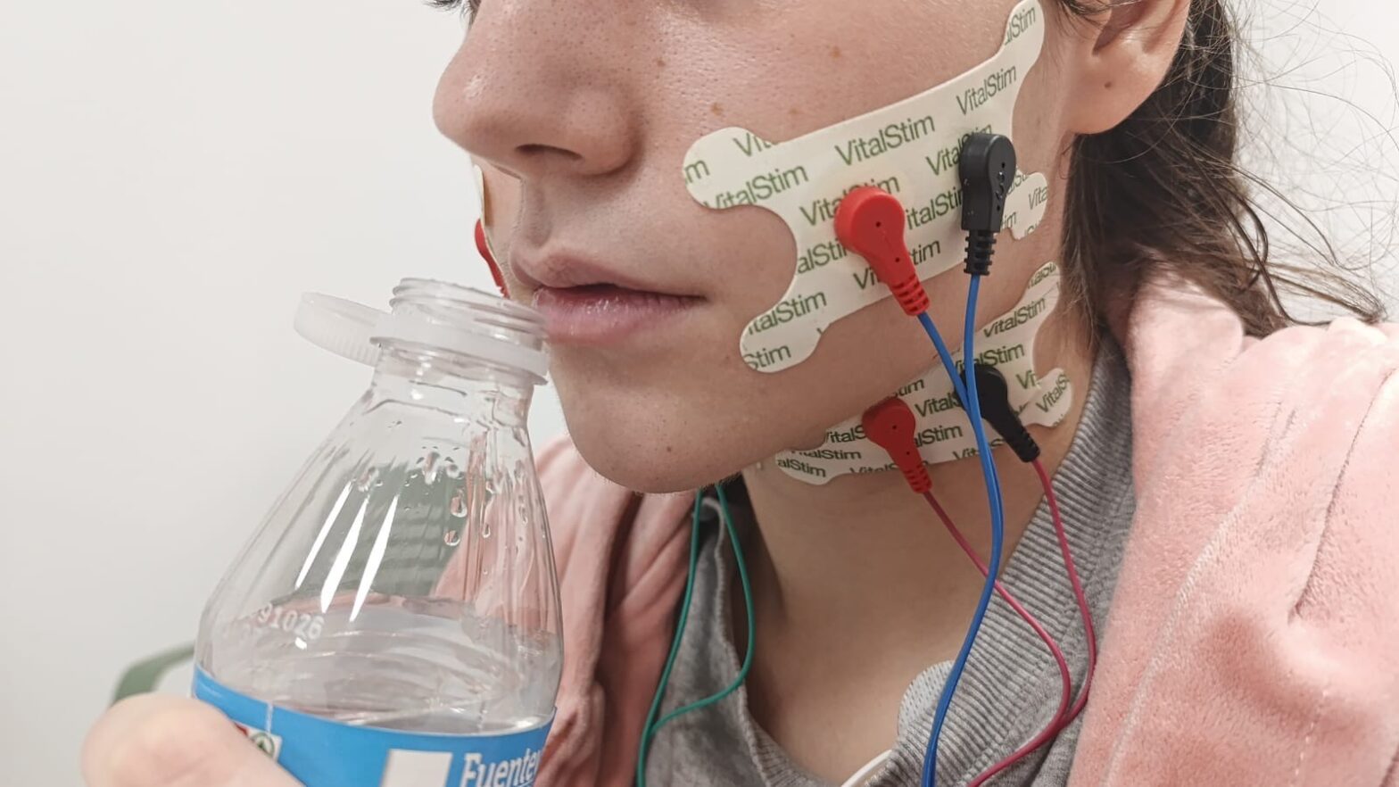 Vitalstim, un dispositivo para mejorar la deglución